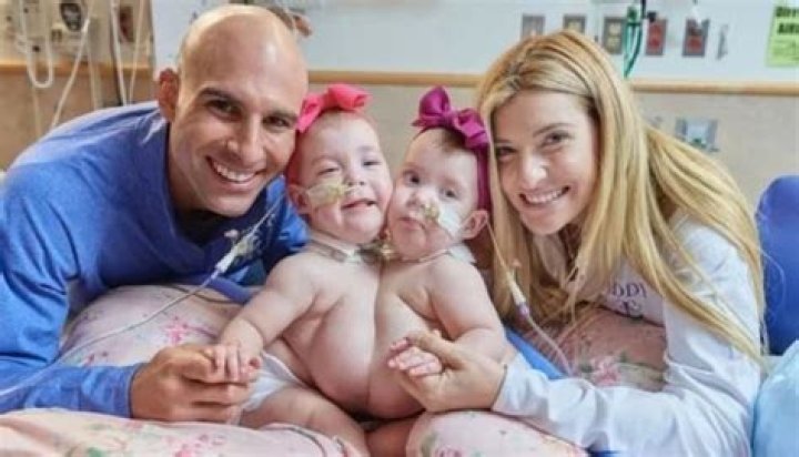
Addison and Lilianna Altobelli Family Meet The Parents Of The Conjoined Twins Separated From Surgery 