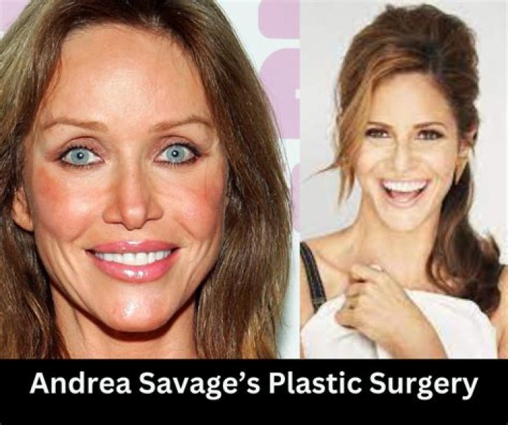Andrea Savage Plastic Surgery: What Did She Do? Before And After Photo