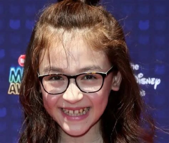 Anna Cathcart Missing Teeth Theory Debunked
