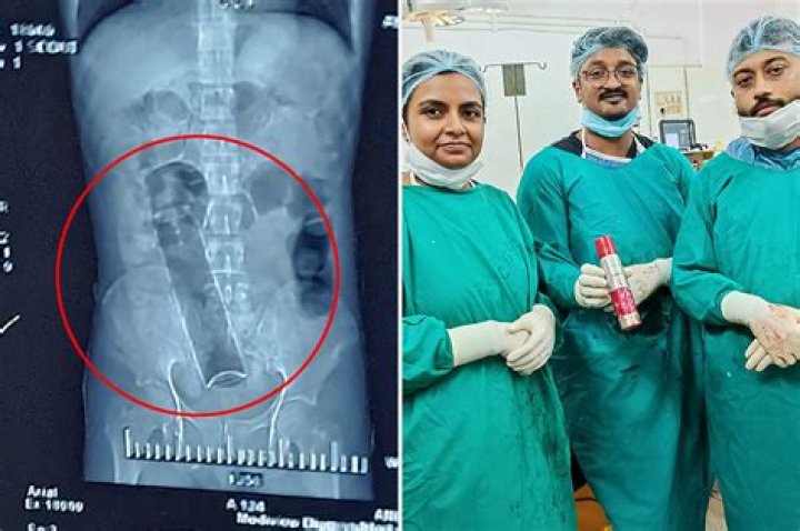 
‘Bum pong!’: Drunk man hospitalized as he inserts drinking glass into rectum for ‘sexual gratification’ 