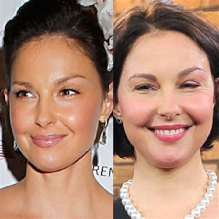 
Does Ashley Judd Have Cancer? What Happened To Her Face? 