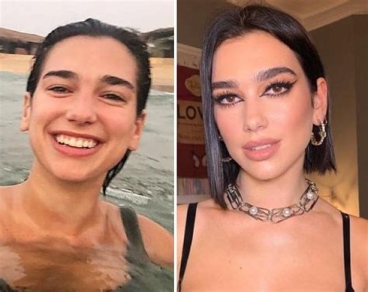 
Dua Lipa Nose Job – Did She Underwent Surgery? Before And After 