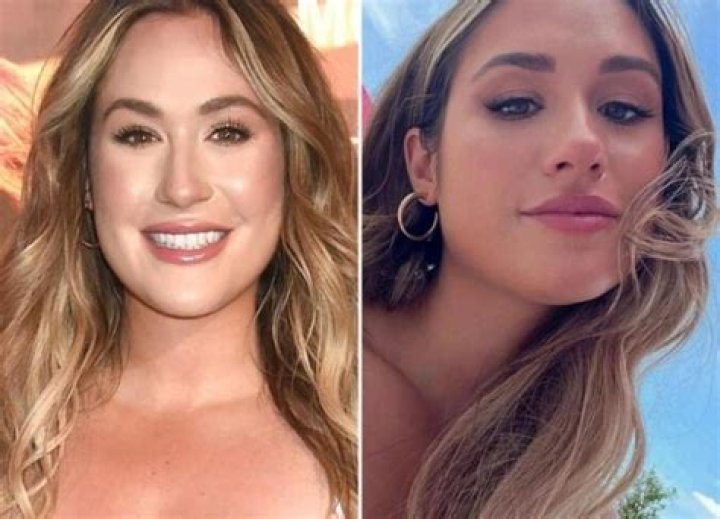 Has Rachel Recchia Done Plastic Surgery? Fans Curious About Botox And Lip Surgery!