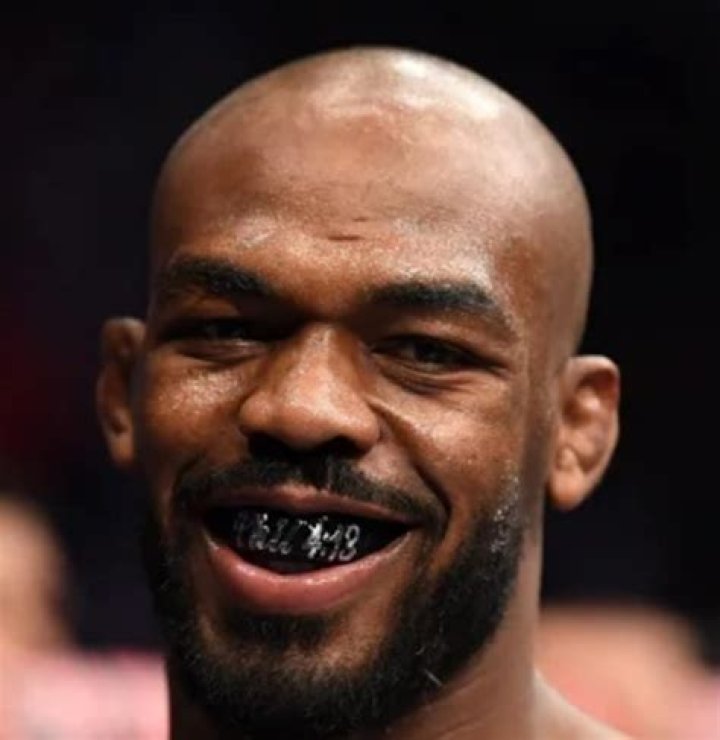 Jon Jones Teeth Before And After: What Does He Have On His Teeth?