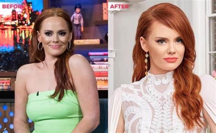 
Kathryn Dennis Weight Loss, Net Worth and 5 Other Interesting Facts 