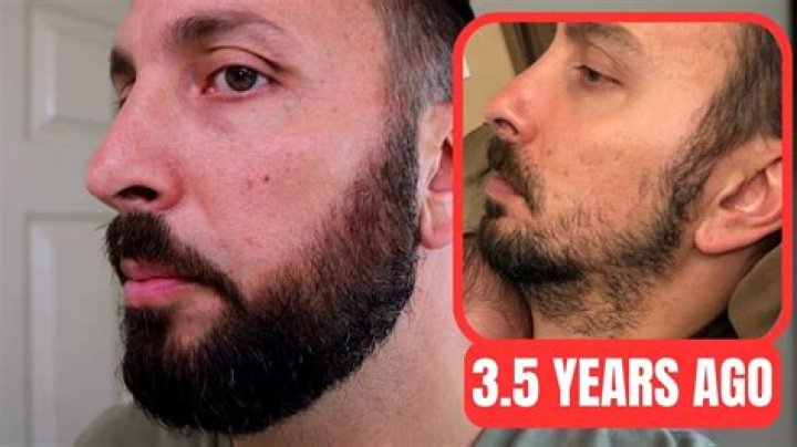 
Mom Stops Shaving Beard After 30 Years, Documents Growth Journey on TikTok 