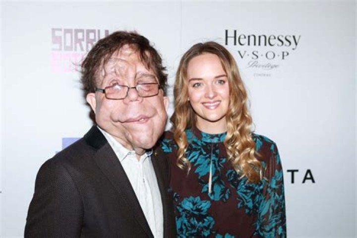 
Morning Anchor Jay Greene KCRG Was Fired, What Did He Do? 