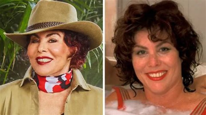 Ruby Wax Had A Plastic Surgery: Before & After Photos