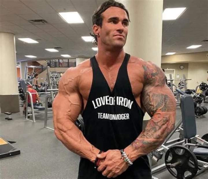 
What happened to Calum Von Moger in his recent accident? Injury and health update of the Australian actor and bodybuilder revealed 