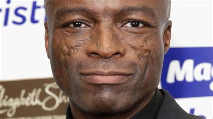 What Happened To Seal That Caused The Extensive Scarring On His Face?