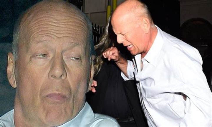Whats Wrong With Bruce Willis? Aphasia Condition Led To Acting Retirement