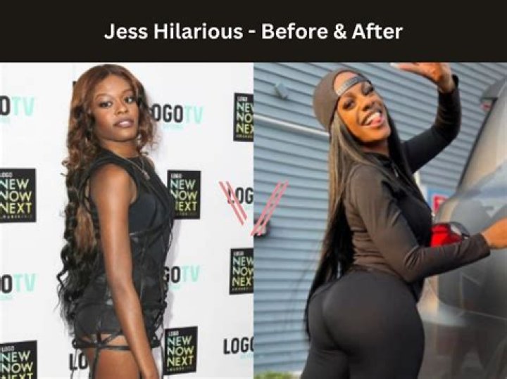 Who Is Jess Hilarious? Stand-up Comedian Before And After Surgery Body, Here Is Every Details