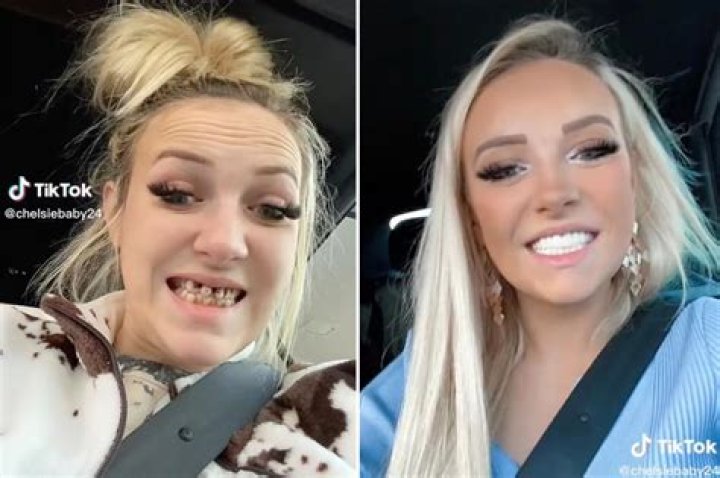 
Who Is Yellow Teeth Girl On TikTok? Reddit Reaction And Photos 